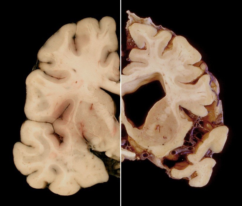 Macroscopic brain Macroscopic brain