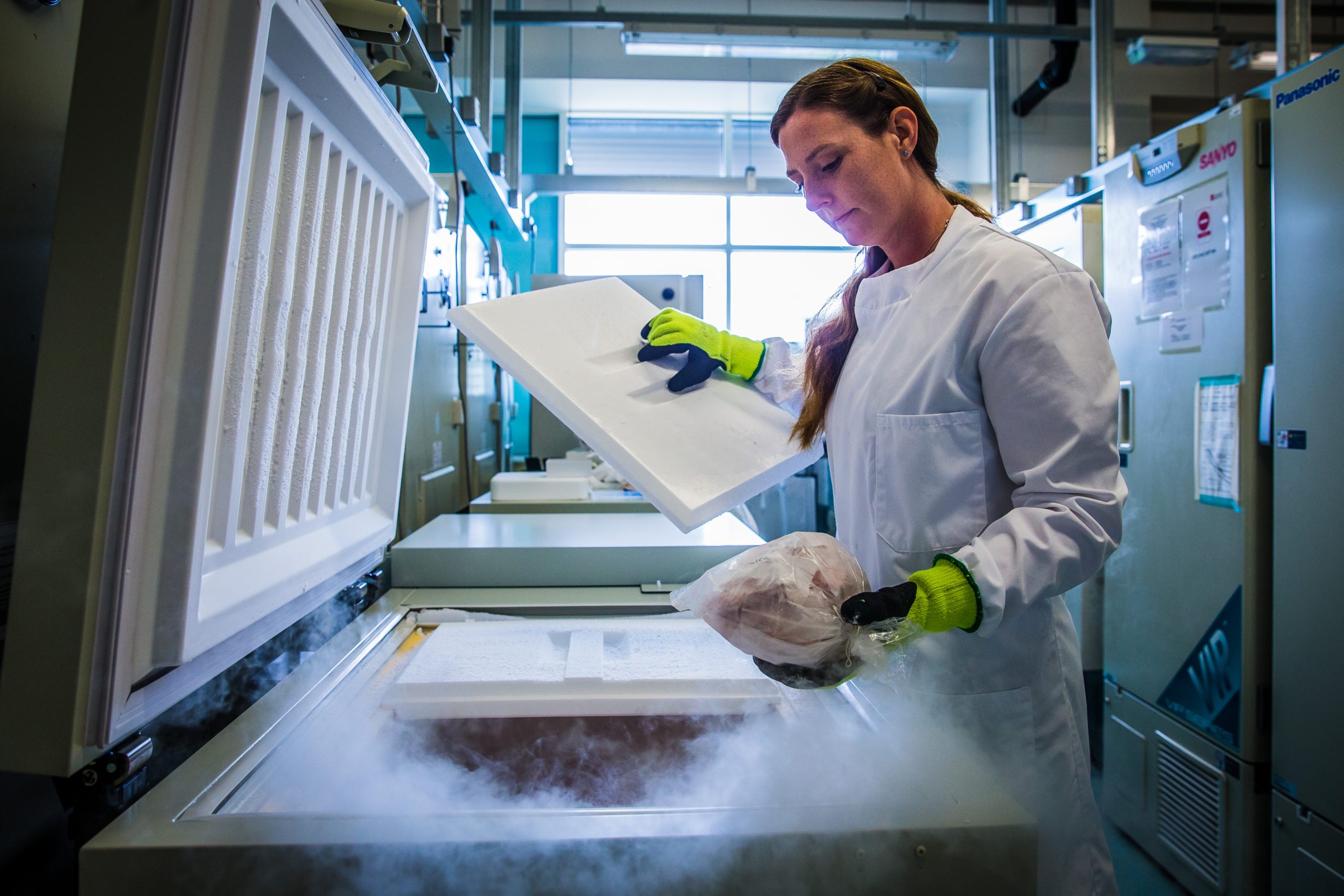 Dr Laura Palmer, 36, examines brain samples stored in a freezer at -150 degrees centigrade at the Brain Bank at Southmead Hospital, Bristol. July 17 2017.