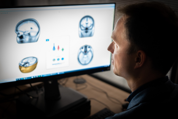 Researcher George Stothart is looking at scan images of brains on a computer screen.