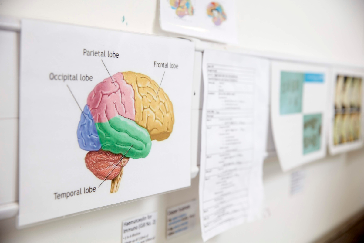 Why we fight appeal 1 day A poster of a drawing of a brain.