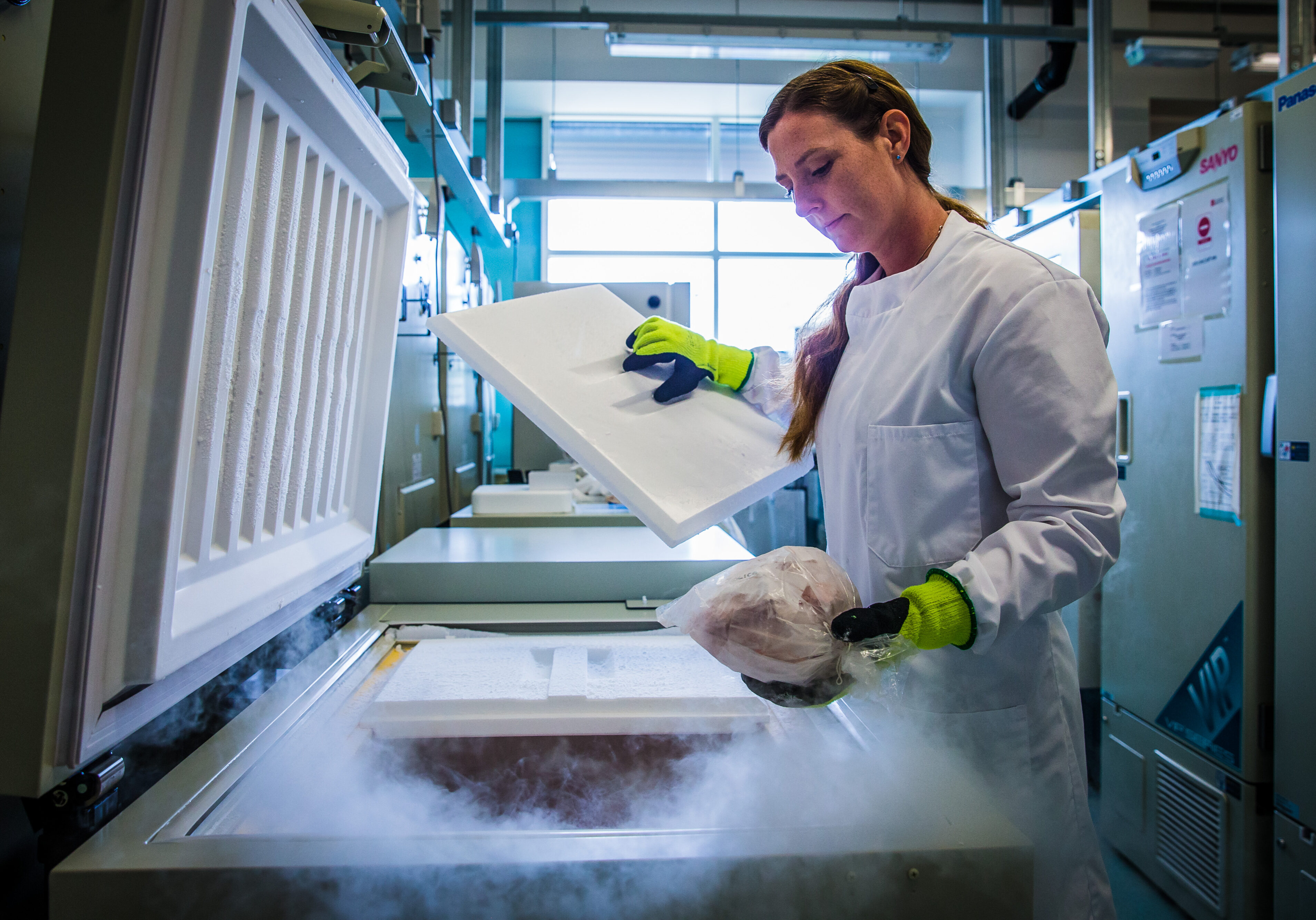 Dr Laura Palmer, 36, examines brain samples stored in a freezer at -150 degrees centigrade at the Brain Bank at Southmead Hospital, Bristol. July 17 2017.